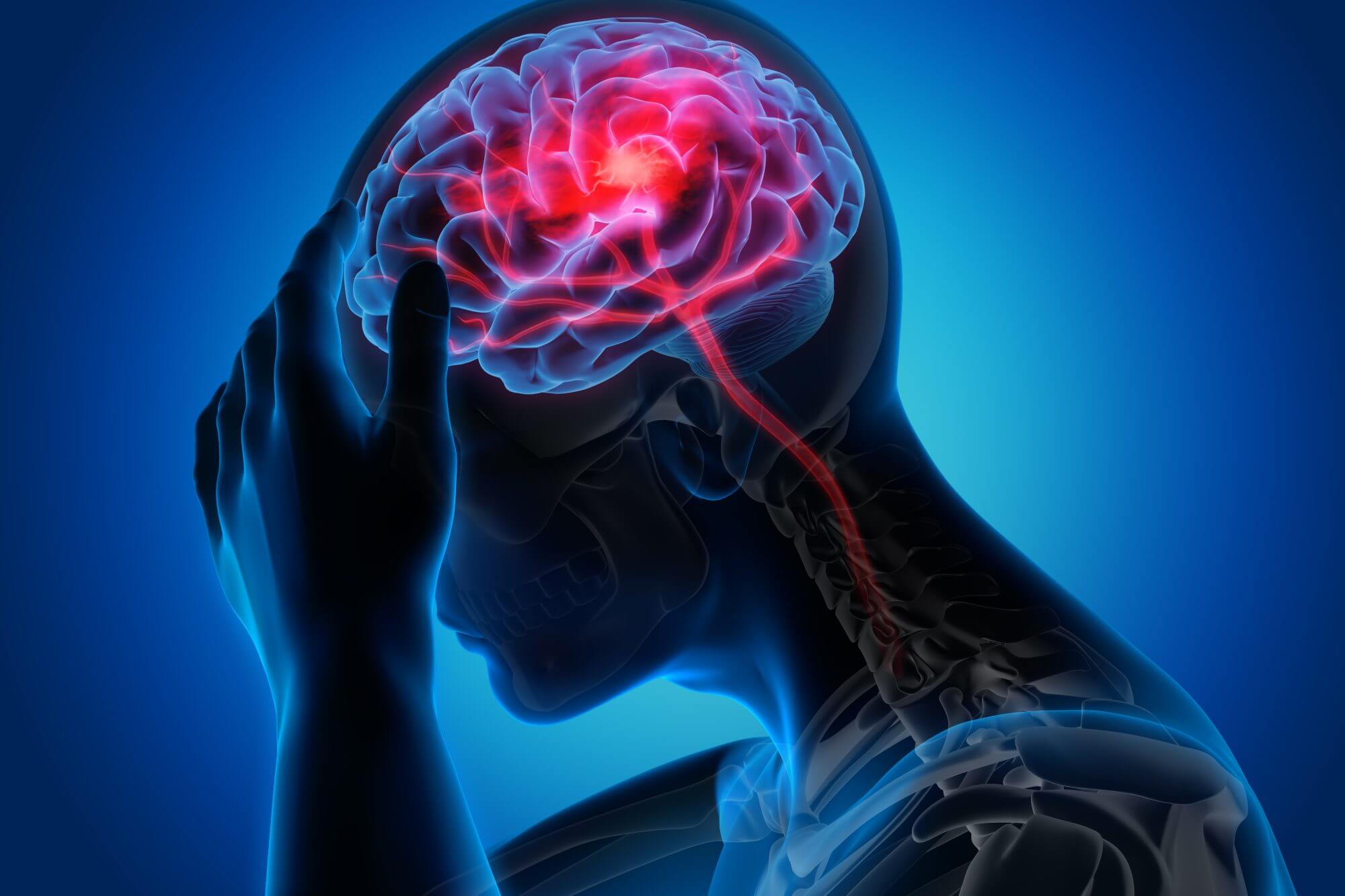 Traumatic Brain Injury Law